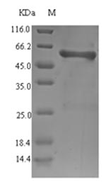 (Tris-Glycine gel) Discontinuous SDS-PAGE (reduced) with 5% enrichment gel and 15% separation gel.